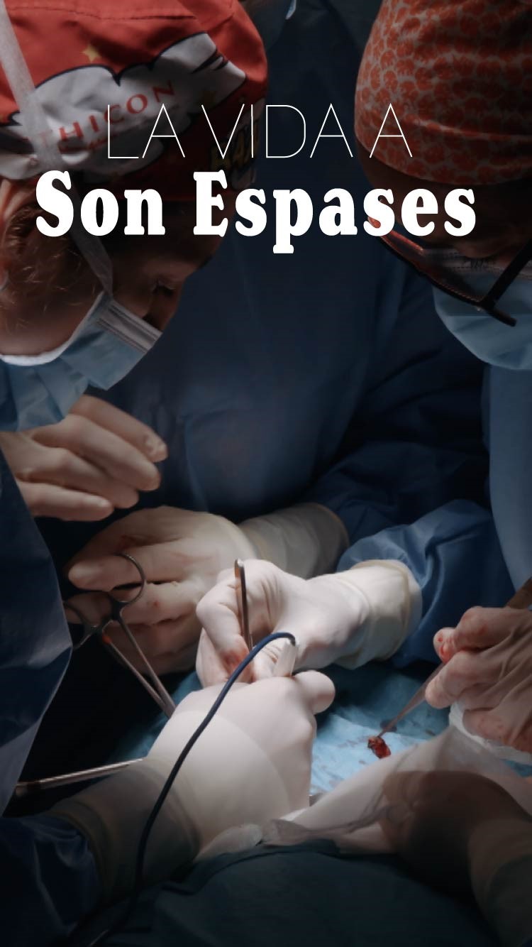 La vida a Son Espases