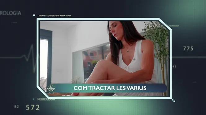 VARIUS, UN PROBLEMA ESTÈTIC I VASCULAR