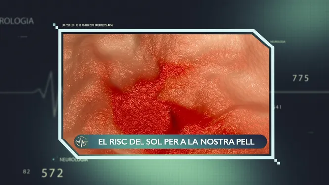 EL PERILL DEL SOL PER A LA PELL
