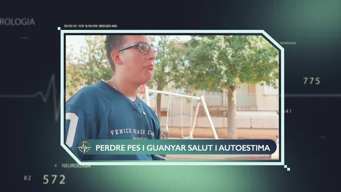 OBESITAT I SOBREPÈS INFANTIL